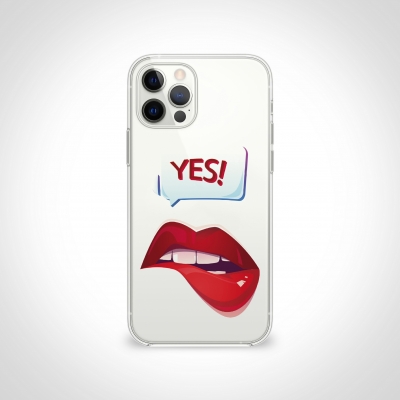 Kiss Yes ŞeffafTelefon Kılıfı